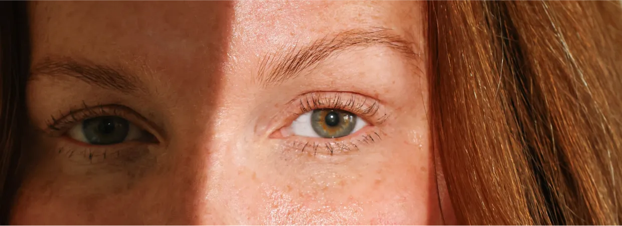 toty blog header — how to prevent and reverse sun damage on skin