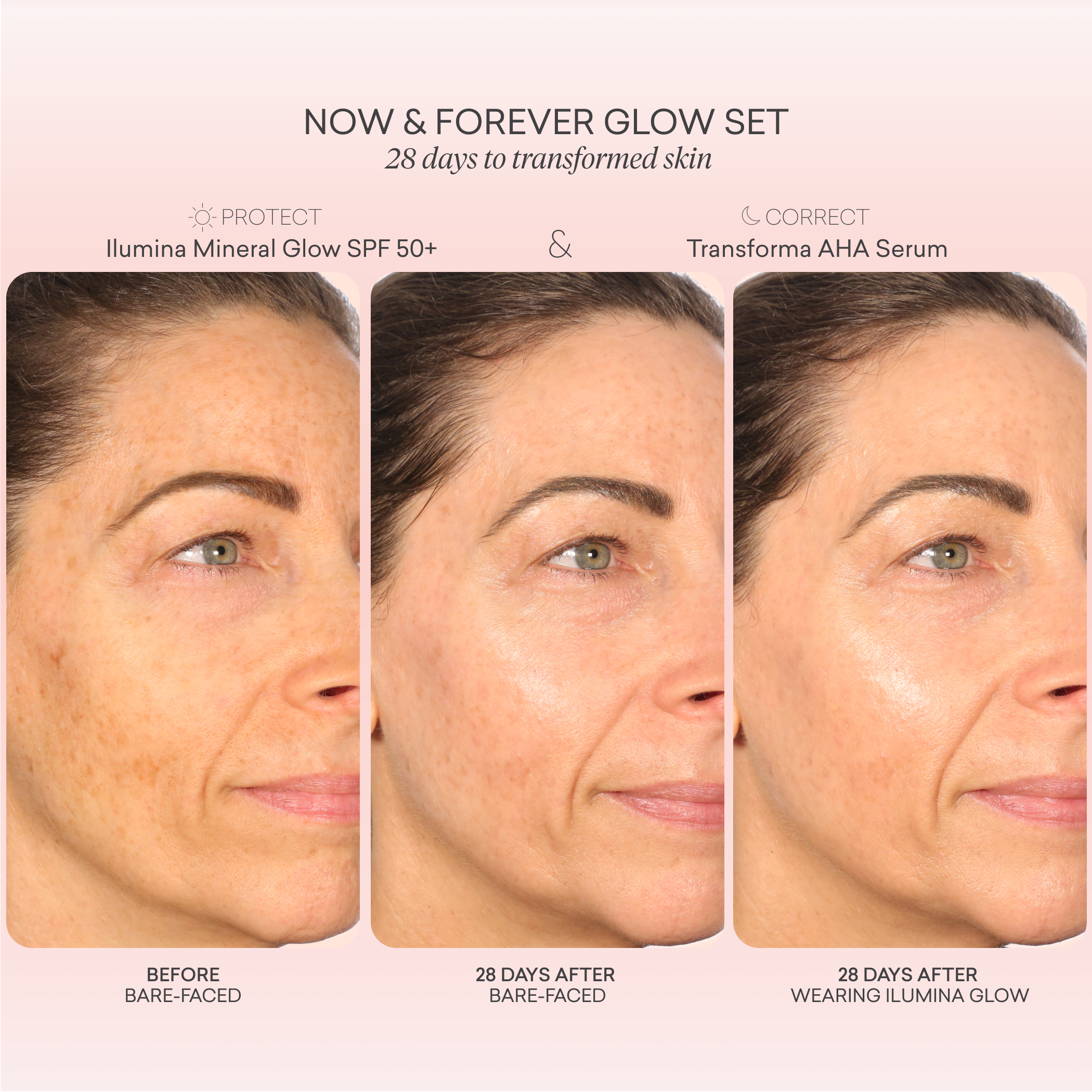 Now & Forever Glow Set