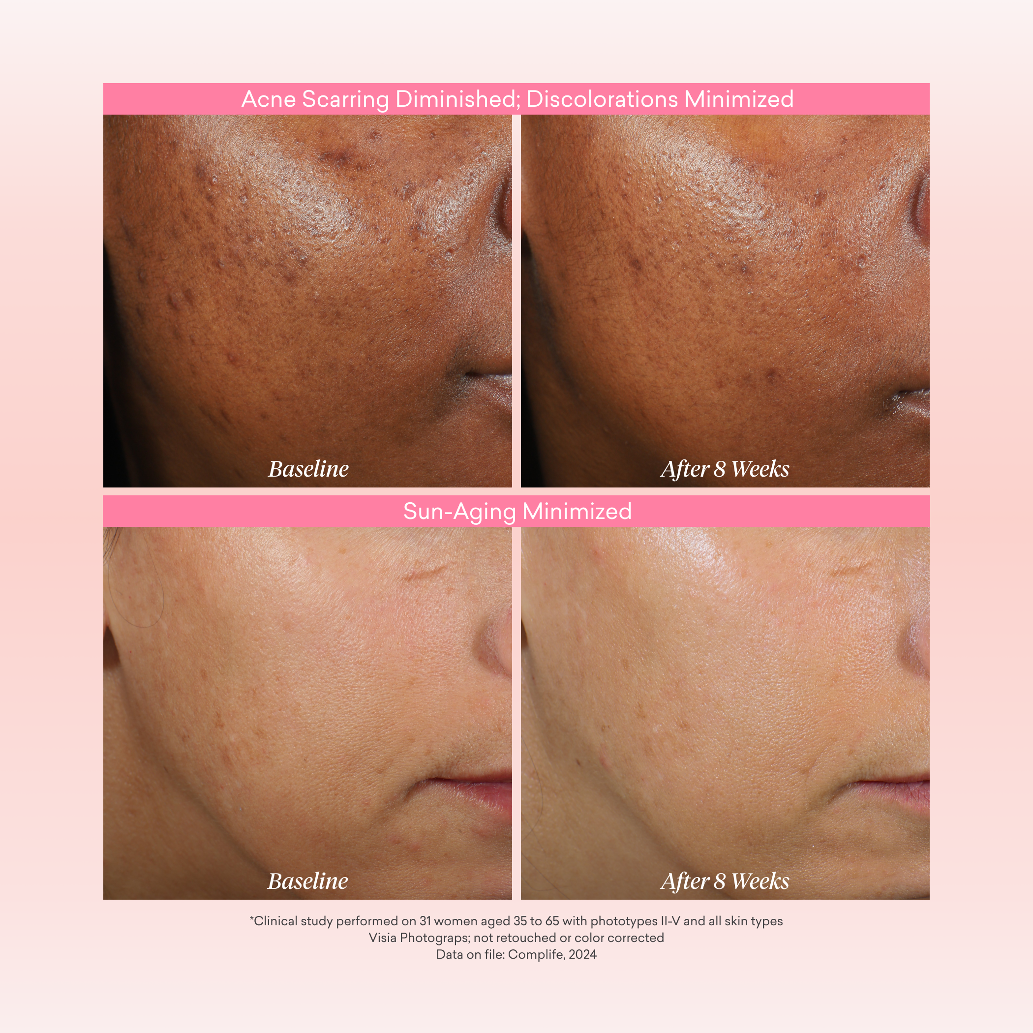 Reversa Retinol Serum