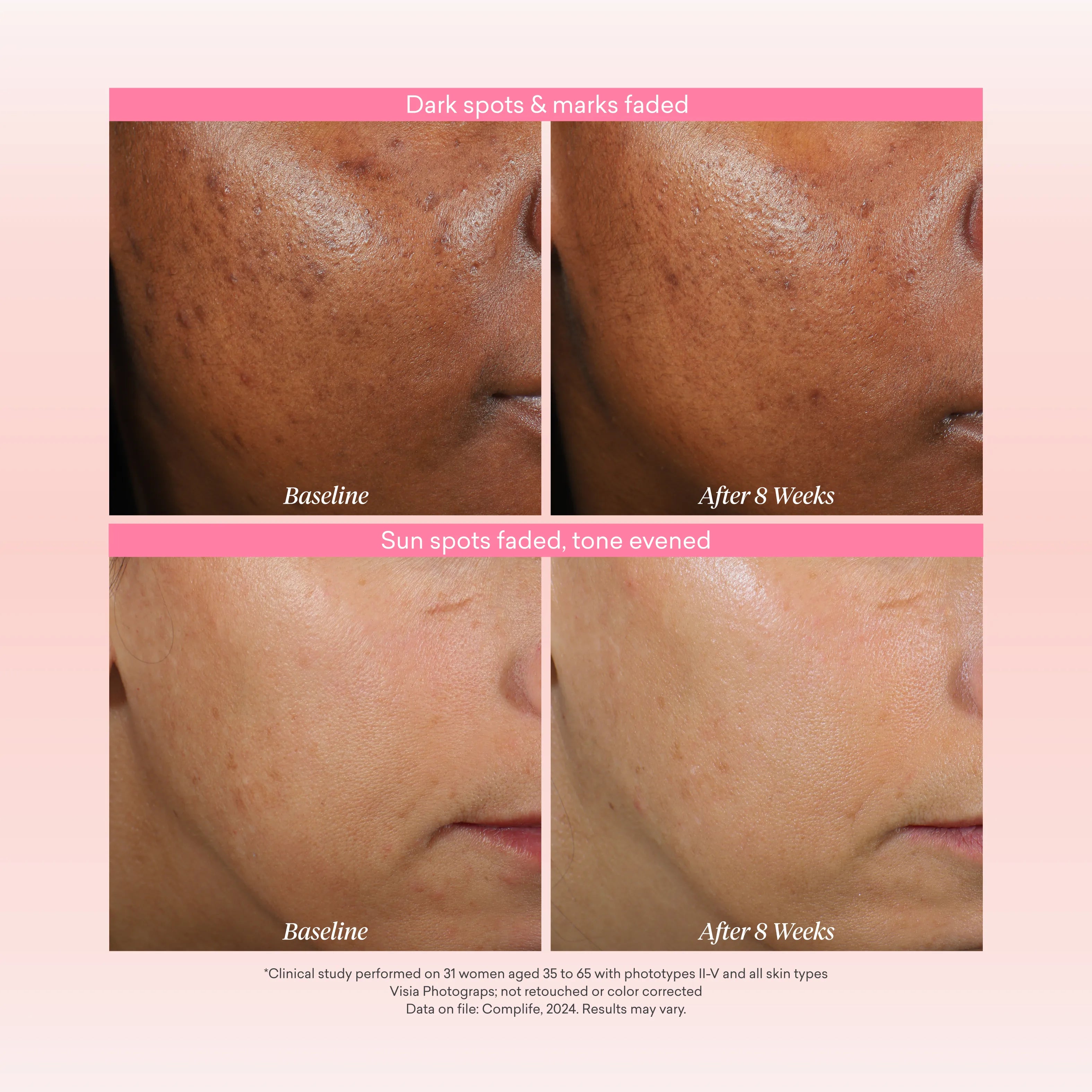 Reversa Retinol
